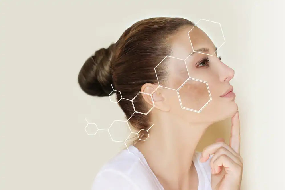 Hiperpigmentarea pielii: cauze, tratamente și sfaturi de prevenire